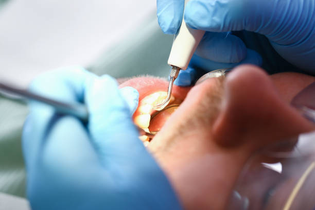 Best Emergency Treatment for Jaw Pain or Injury in Freedom, CA